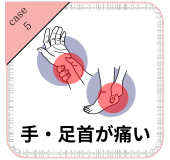 手首が痛い